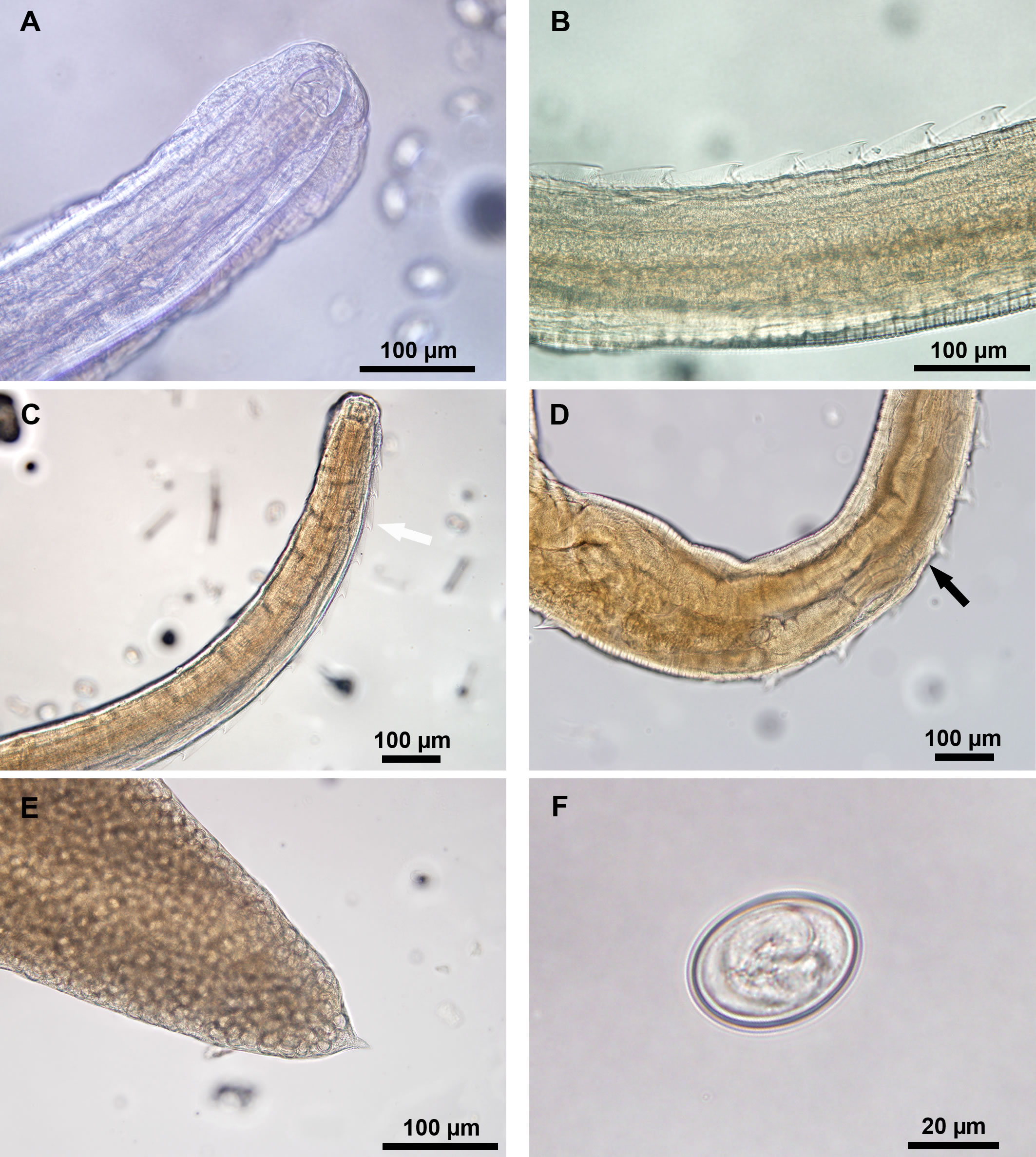Detalles anatómicos de hembra de Pterygodermatitess kozeki